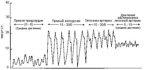 Значения ДЗЛА